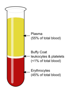 An image of blood separated into its different components via centrifugation for use in PRP preparation