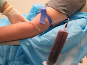 A photo of a medical professional drawing a patient's blood for the preparation of Pure PRP.  The image shows a syringe filled with blood connected to the patients arm via a butterfly needle as well as a tourniquet applied.