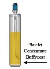 EmCyte PRP processing step showing the formation of the buffy coat at the bottom of the concentration device after the second spin