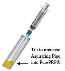 EmCyte PRP process showing the necessary tilt required of the second concentrating device to immerse the aspirating pipe into the PRP